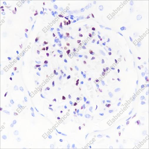 Recombinant ERG Monoclonal Antibody - 2