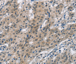 SMAD9 Polyclonal Antibody - 3