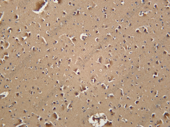 Recombinant PTN Monoclonal Antibody - 1