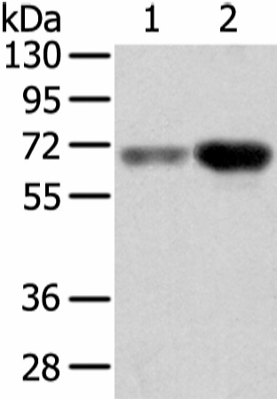 Western Blot analysis of Human lung cancer and placenta tissue using TBL1X Polyclonal Antibody at dilution of 1/500