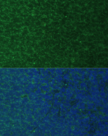 Immunofluorescence analysis of Rat breast cells using PMAIP1 Polyclonal Antibody at dilution of  1:100. Blue: DAPI for nuclear staining.