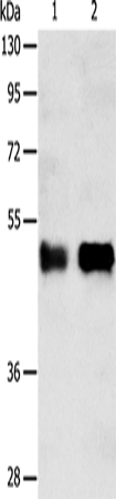 Western Blot analysis of Human liver cancer tissue and A549 cell using SERPINA5 Polyclonal Antibody at dilution of 1:750