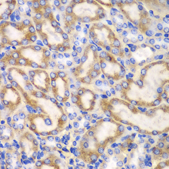 Immunohistochemistry of paraffin-embedded Mouse kidney using UGDH Polyclonal Antibody at dilution of 1:100 (40x lens).