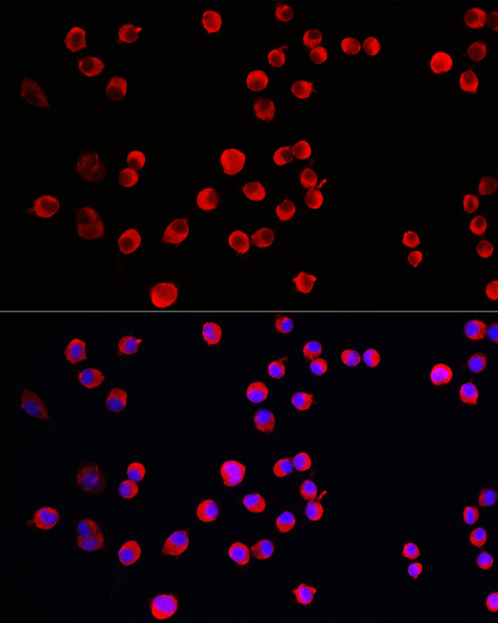 Immunofluorescence analysis of Neuro-2a cells using PTPN5 Polyclonal Antibody at dilution of 1:100 (40x lens). Blue: DAPI for nuclear staining.