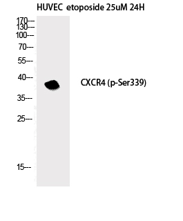 Western Blot analysis of HuvEc etoposide 25uM 24h cells with Phospho-CXCR4 (Ser339) Polyclonal Antibody