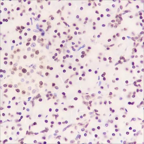 Recombinant FUBP1 Monoclonal Antibody - small - 3