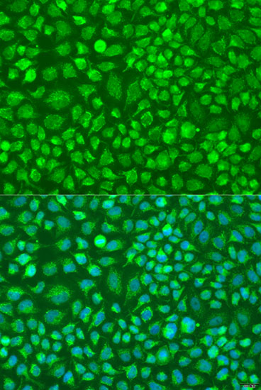 Immunofluorescence analysis of U2OS cells using DNAL1 Polyclonal Antibody at dilution of 1:100. Blue: DAPI for nuclear staining.