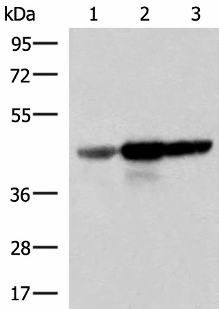 Western blot analysis of Human fetal brain tissue HepG2 and HT29 cell lysates  using FDFT1 Polyclonal Antibody at dilution of 1:1000