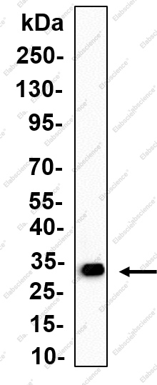 Recombinant ASPA Monoclonal Antibody - 1