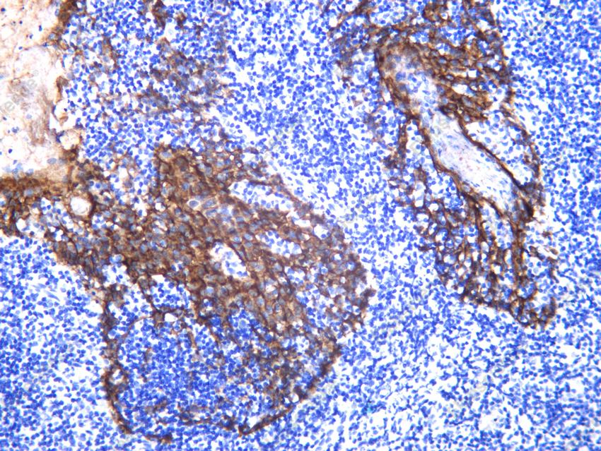 Recombinant Claudin-1 Monoclonal Antibody - 8