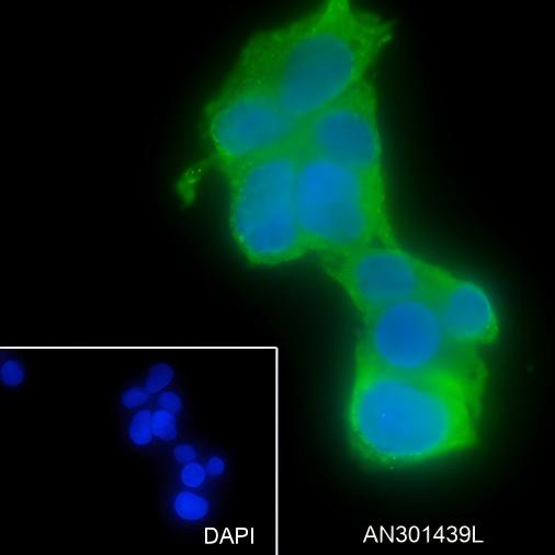 Recombinant ASGR1 Monoclonal Antibody - small - 5
