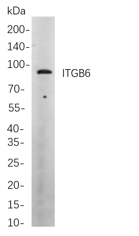 Recombinant ITGB6 Monoclonal Antibody-searchlist-1