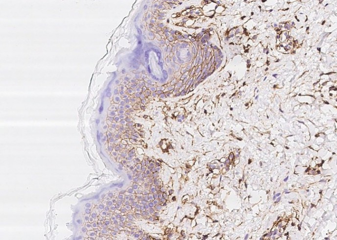CD44 Antibody Polyclonal Antibody - small - 2