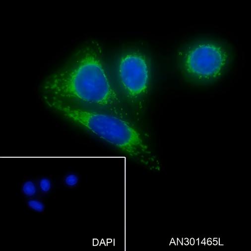 Recombinant CD168 Monoclonal Antibody - 2
