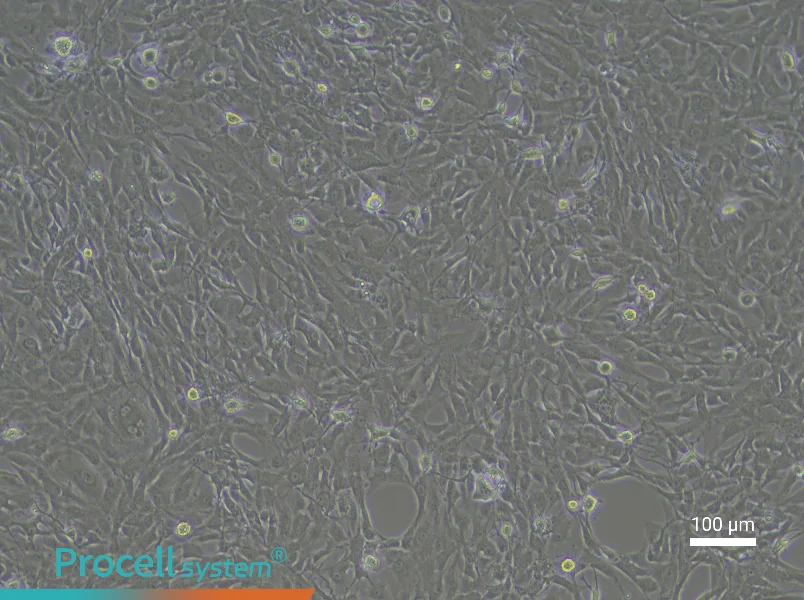 Rat Meningeal Fibroblast Complete Medium - 3