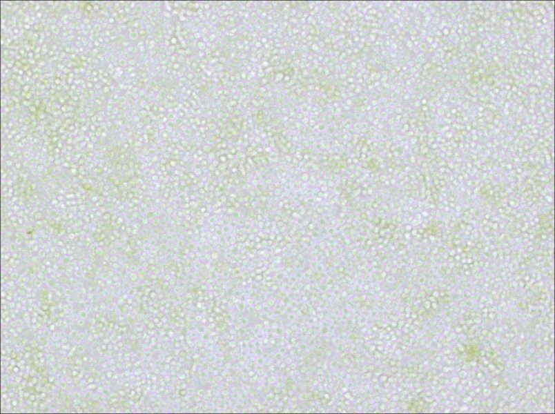 OKT 11 Cell Complete Medium - small - 4