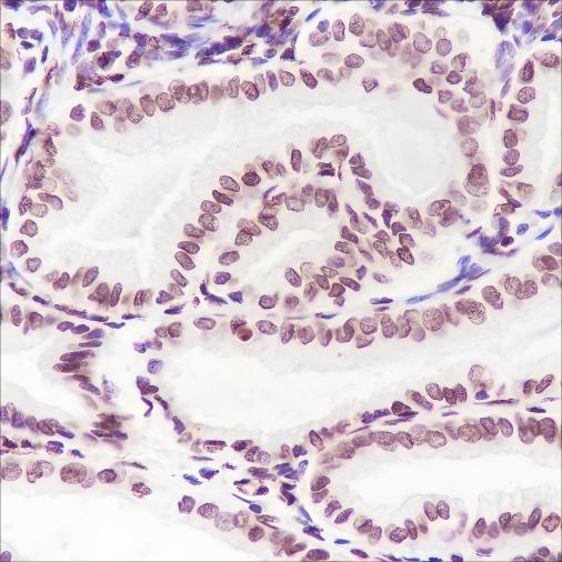 Recombinant Phospho-Cyclin D1 (Thr286) Monoclonal Antibody - small - 2