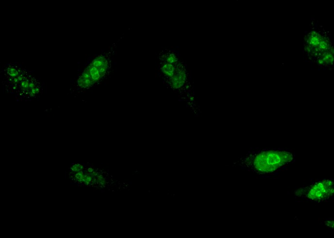 MKI67 Monoclonal Antibody-searchlist-1