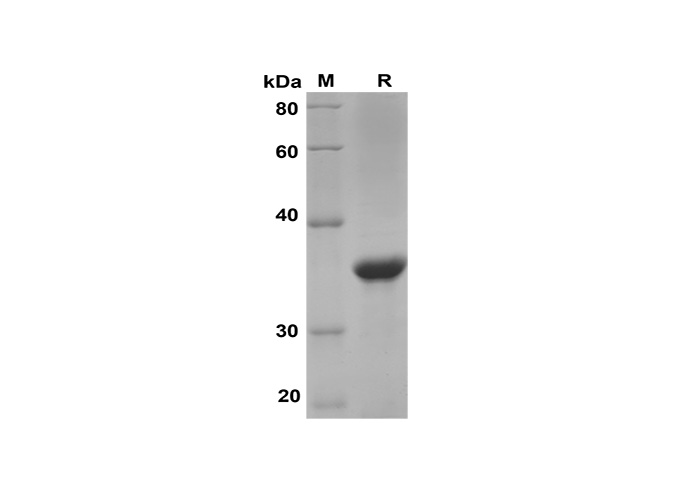 Recombinant Human PD1 Protein(His Tag)-产品推荐-1