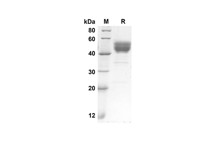 Recombinant Mouse IL-5 Protein(Fc Tag)-产品推荐-1