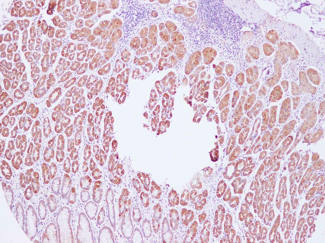 Immunohistochemistry of paraffin-embedded Human stomach using Cytochrome c1 Polyclonal Antibody at dilution of 1:100(100x)