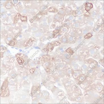 Recombinant FASN Monoclonal Antibody - 5