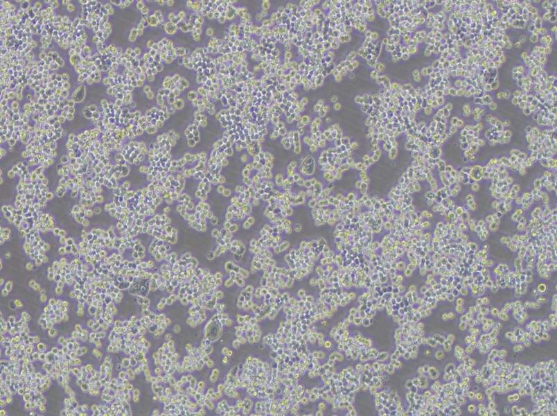 COLO 320DM Cell Complete MediumCOLO 320DM Cell Complete Medium - 2