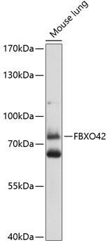 Western blot analysis of extracts of mouse lung using FBXO42 Polyclonal Antibody at 1:1000 dilution.