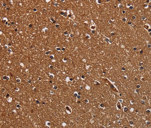 Immunohistochemistry of paraffin-embedded Human brain  tissue using TICAM2 Polyclonal Antibody at dilution 1:60