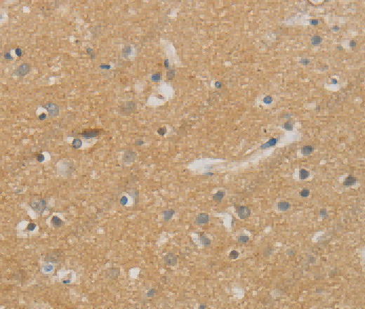 NDRG1 Polyclonal Antibody - 2