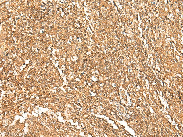 Immunohistochemistry of paraffin-embedded Human tonsil tissue  using GTF3A Polyclonal Antibody at dilution of 1:75(?200)