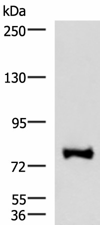 Western blot analysis of TM4 cell lysate  using FOXK2 Polyclonal Antibody at dilution of 1:1000