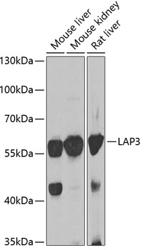 Western blot analysis of extracts of various cell lines using LAP3 Polyclonal Antibody at 1:1000 dilution.