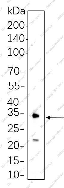 Recombinant IL-1 β Monoclonal Antibody - 1