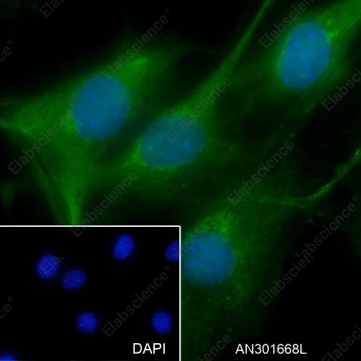 Recombinant SOD1 Monoclonal Antibody - 6