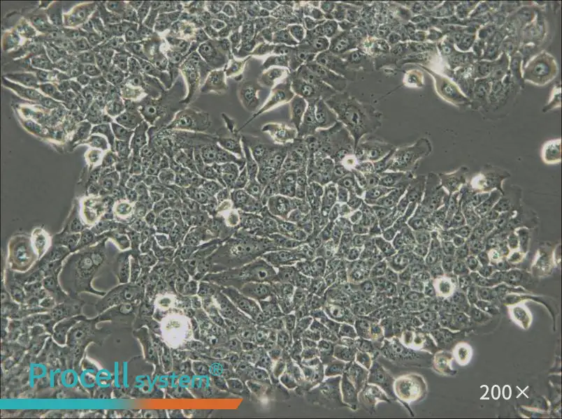 JIMT-1 Cell Complete Medium - small - 4