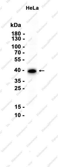 Recombinant FOXF1 Monoclonal Antibody - 1