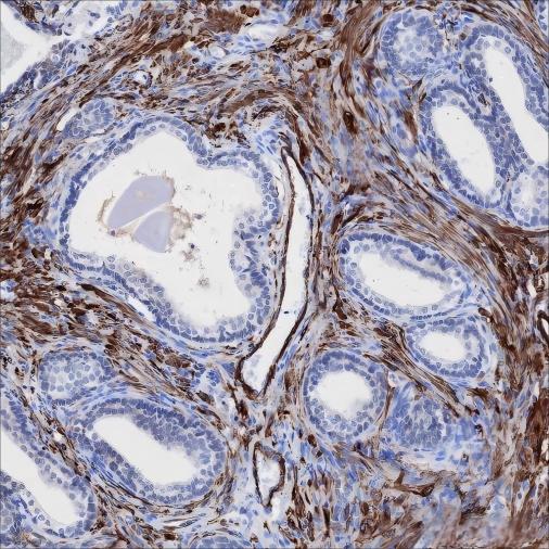 Recombinant Smooth Muscle Myosin heavy chain 11 Monoclonal Antibody - 3