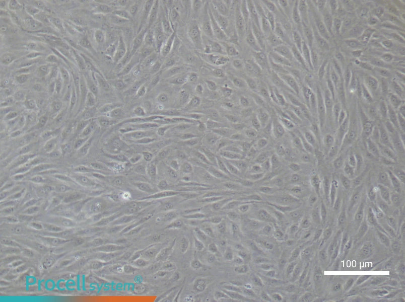 Human Coronary Artery Endothelial Cell Complete Medium - 3