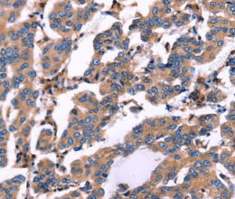 RDX Polyclonal Antibody - 3