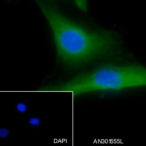 Recombinant HMGCR Monoclonal Antibody - small - 2