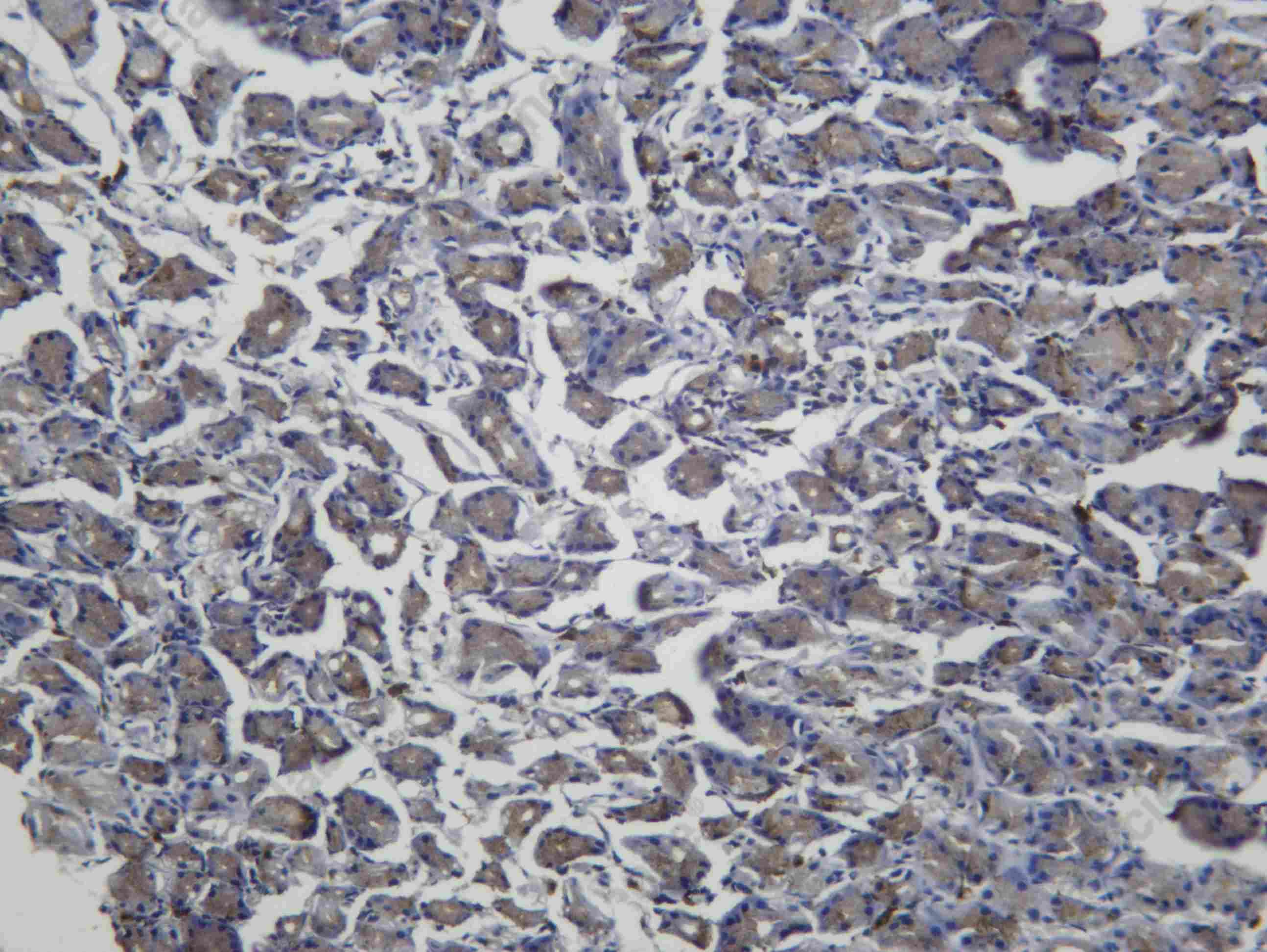 Recombinant Rac1/2/3 Monoclonal Antibody - 2