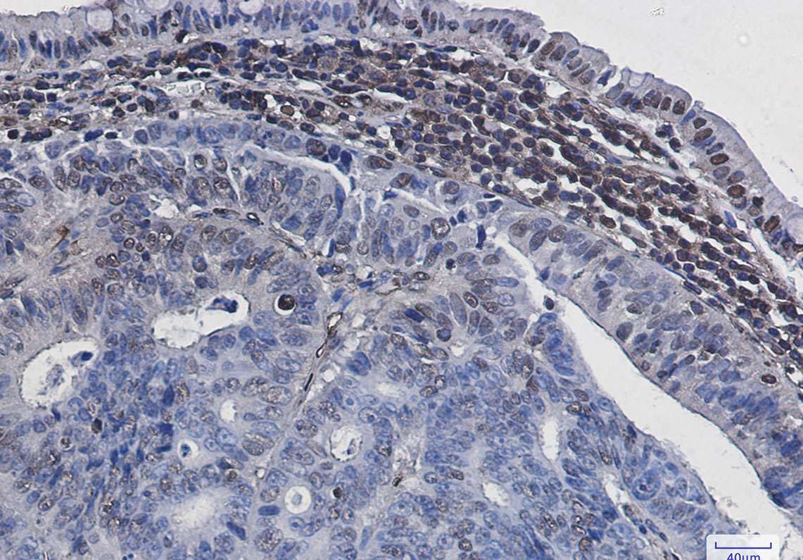 Recombinant Phospho-Histone H3 (Ser28) Monoclonal Antibody - 2
