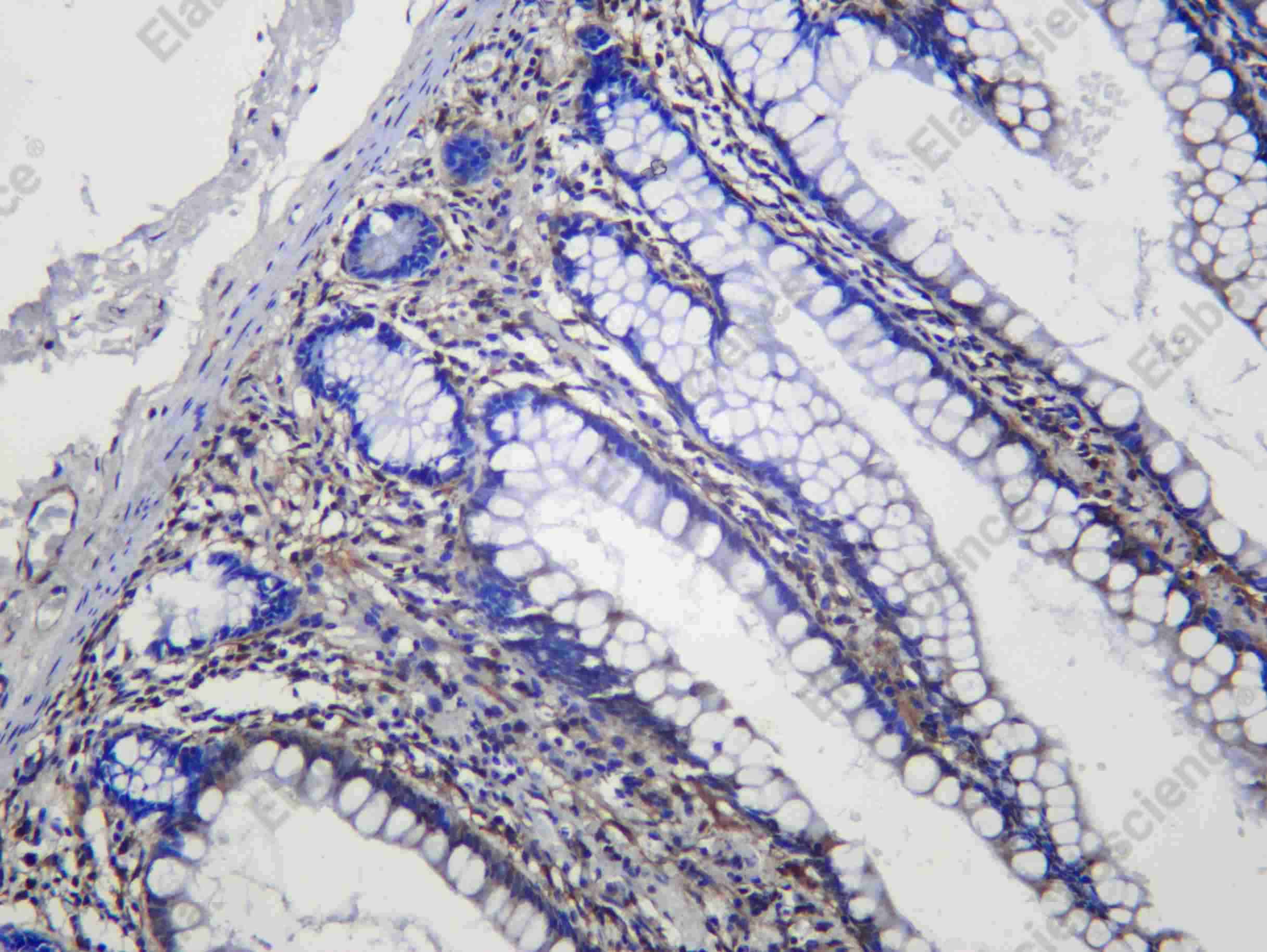 Recombinant GBP2 Monoclonal Antibody - 1