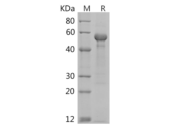 Recombinant Rat IL7R/IL-7R/CD127 Protein(His Tag)-产品推荐-1