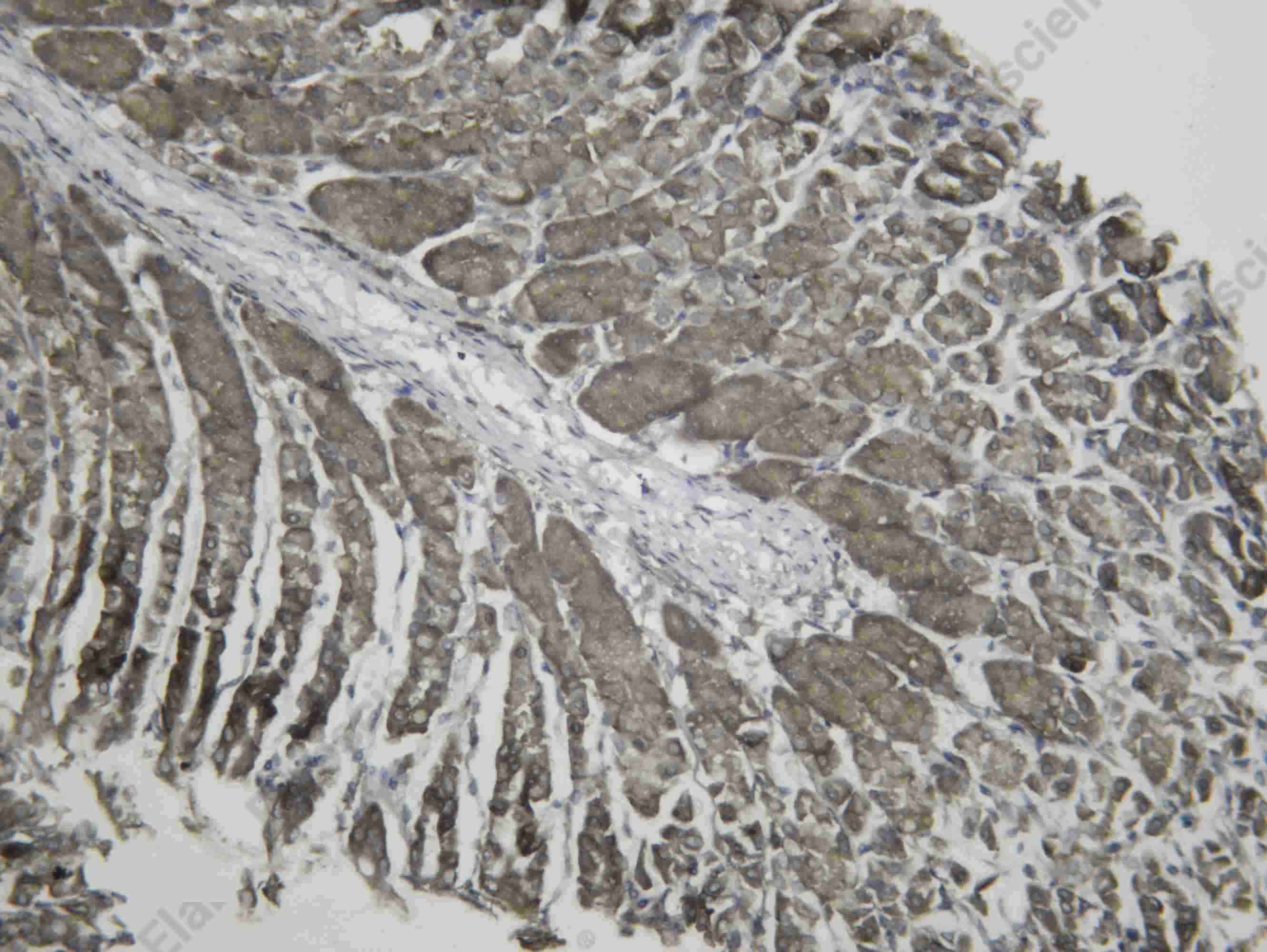 Recombinant Rac1/2/3 Monoclonal Antibody - 3