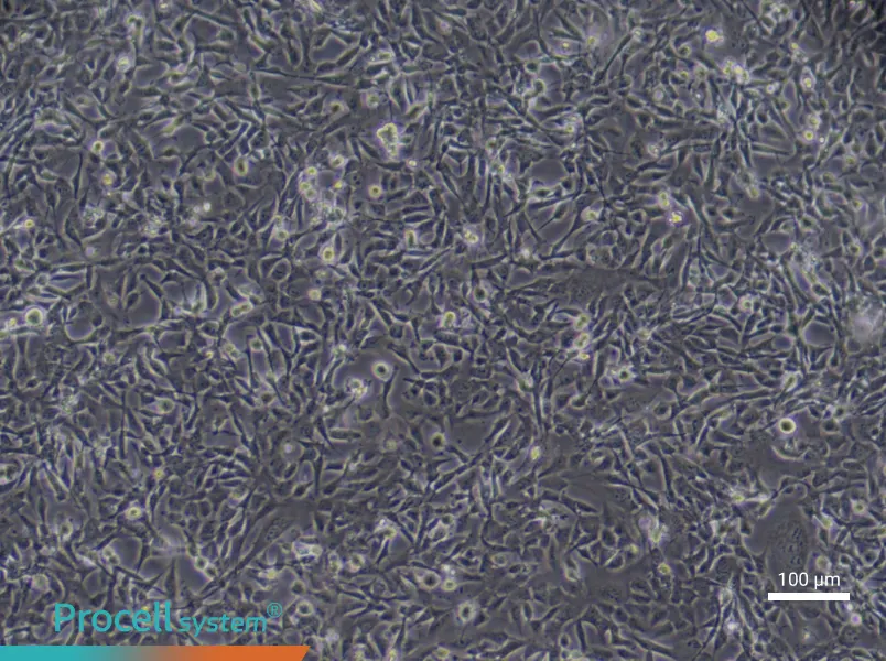 Human Cardiac Microvascular Endothelial (Primary cell immortalization) Cell Complete Medium - 2