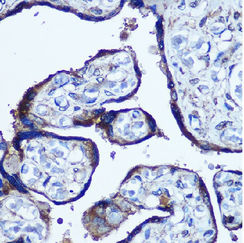 Immunohistochemistry of paraffin-embedded Human placenta using TBCCD1 Polyclonal Antibody at dilution of 1:100 (40x lens).Perform microwave antigen retrieval with 10 mM PBS buffer pH 7.2 before commencing with IHC staining protocol.