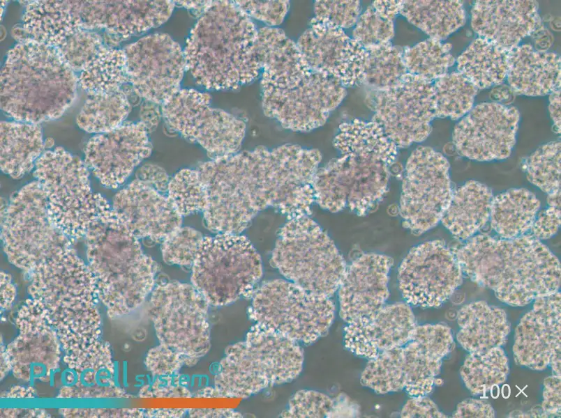 HuT 102 Cell Complete Medium - 1