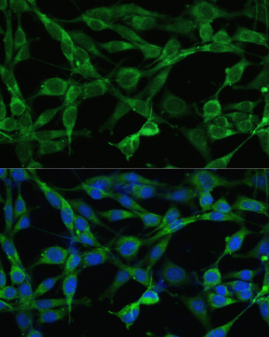 Immunofluorescence analysis of NIH/3T3 cells using SMAD3 Polyclonal Antibody at dilution of  1:100. Blue: DAPI for nuclear staining.